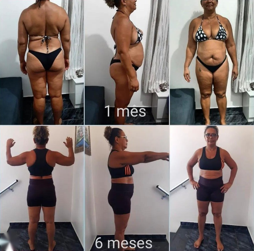 Antes e depois de aluna